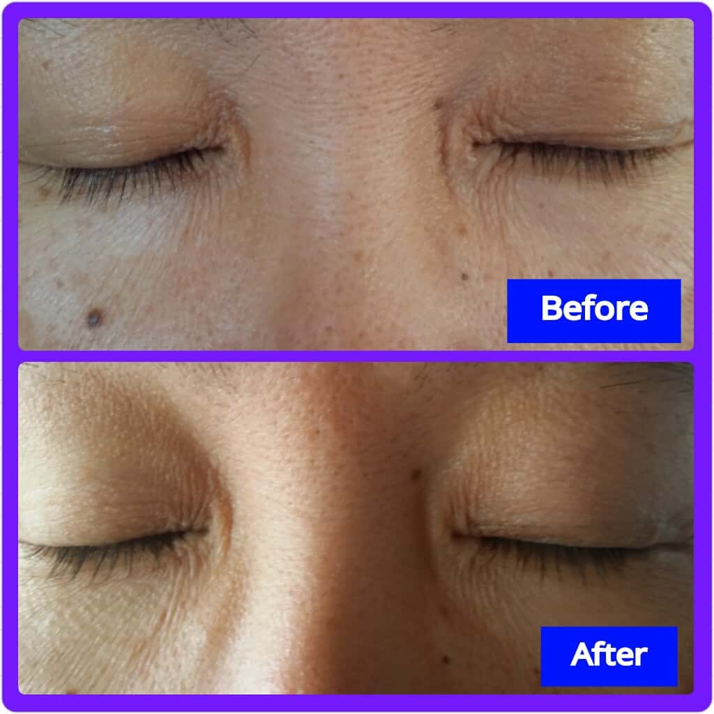 Rapidlash Before and After